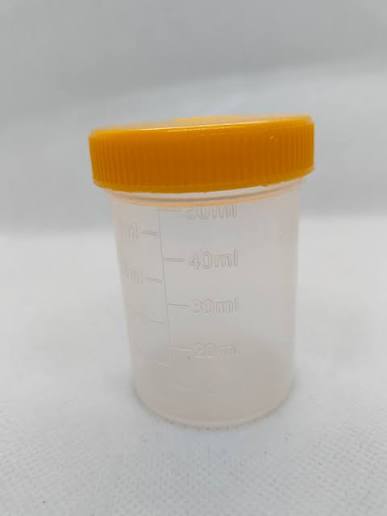 URINE  CONTAINER